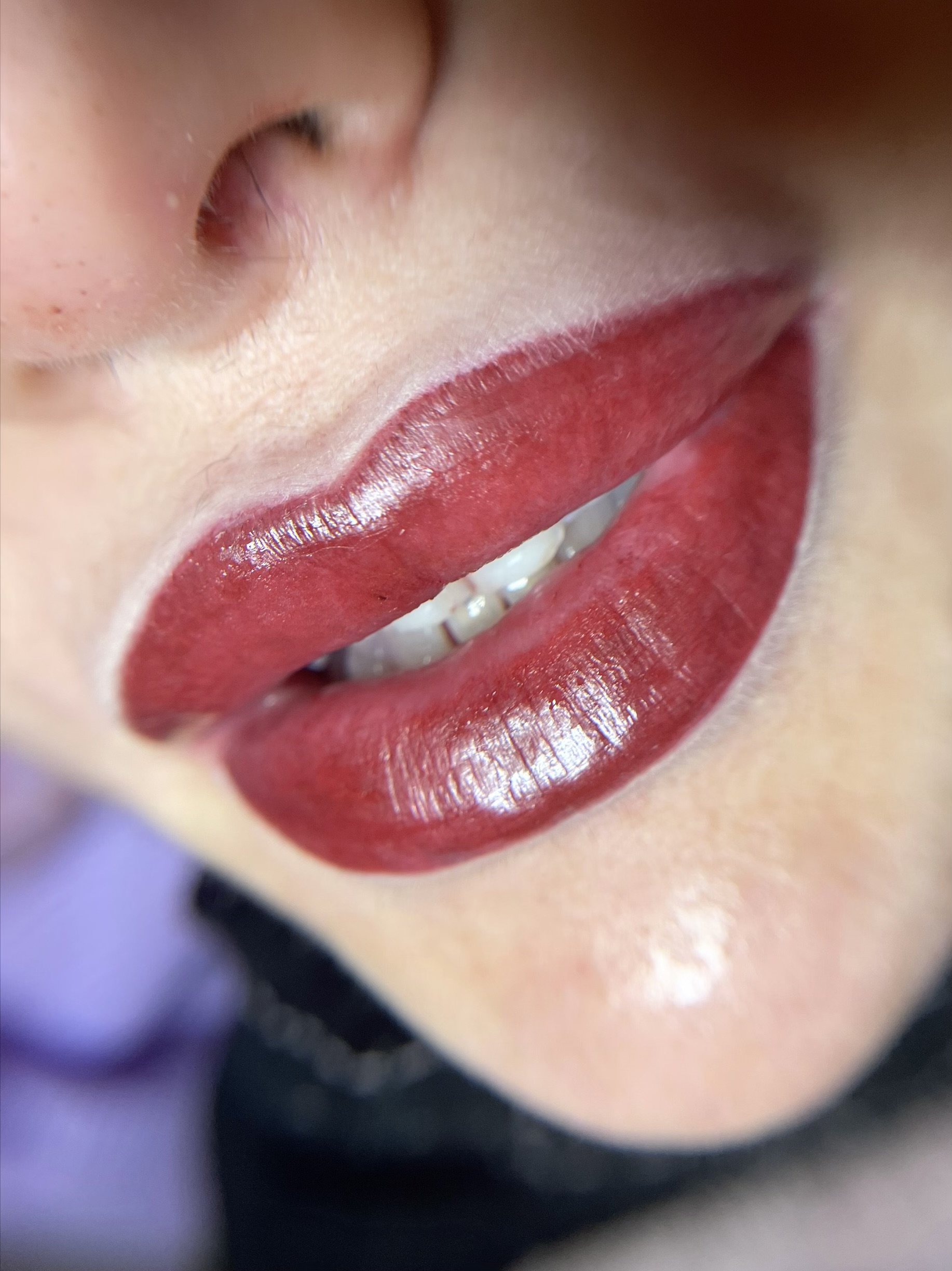 Full Lips